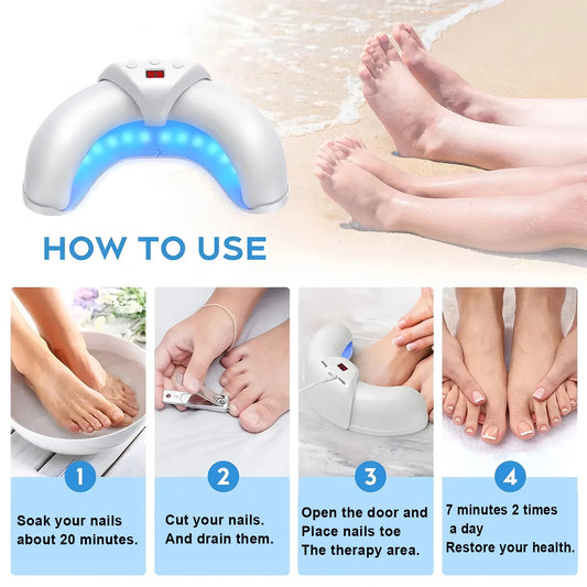 Nail Glow Laser Device